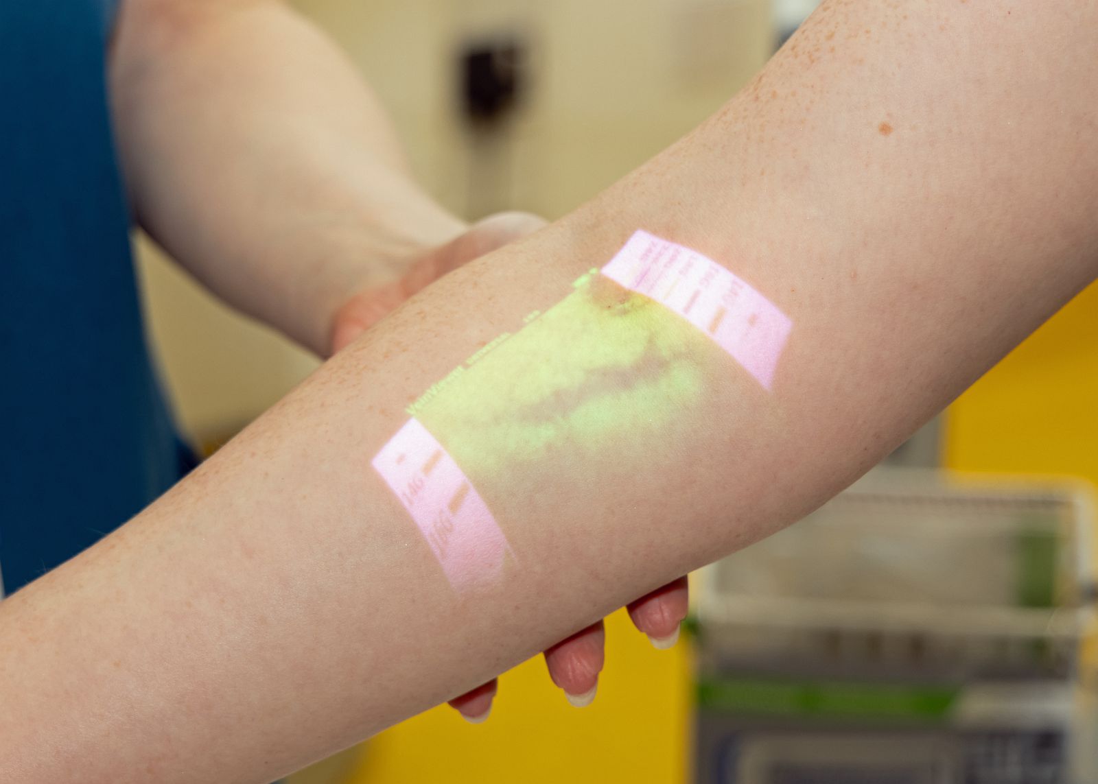 VeinViewer in operation